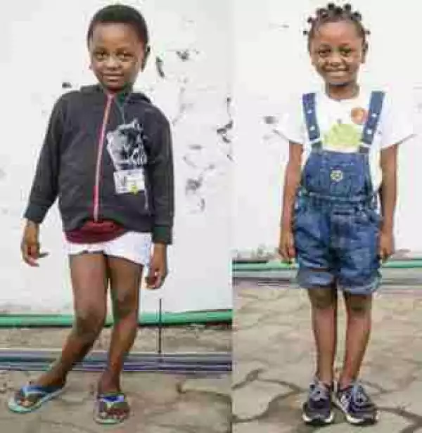 Pretty Little Girl With K-Leg Full Of Smiles After Undergoing Corrective Surgery